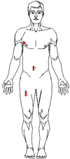 Male: Anterior Measurement Sites